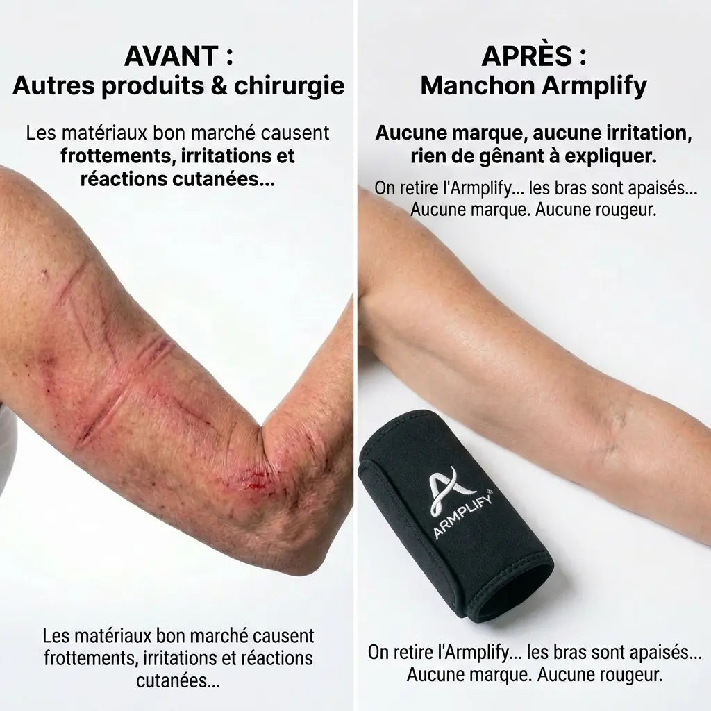 Armplify